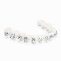 Metal Braces - Central Florida Orthodontic Specialists